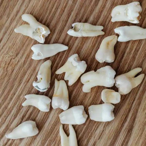 Ta bort en tand tandutdragning